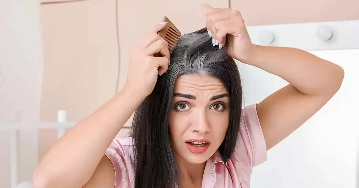 سفید شدن مو در دوران جوانی + علل و روش های درمان سفید شدن مو در دوران جوانی + علل و روش های درمان