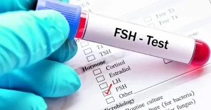 آزمایش FSH چیست؟ اهداف آزمایش FSH