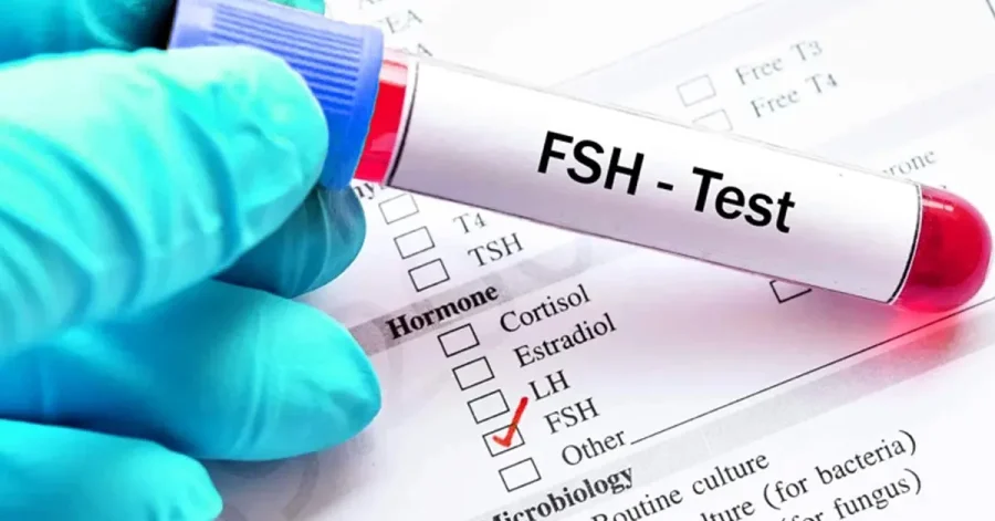 آزمایش FSH چیست؟ اهداف آزمایش FSH