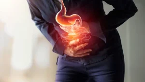 رفلاکس معده چیست؟