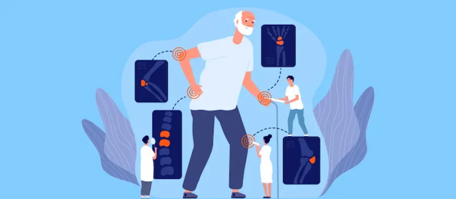 علت‌ها، علائم و راه‌های پیشگیری و درمان پوکی استخوان در سالمندان