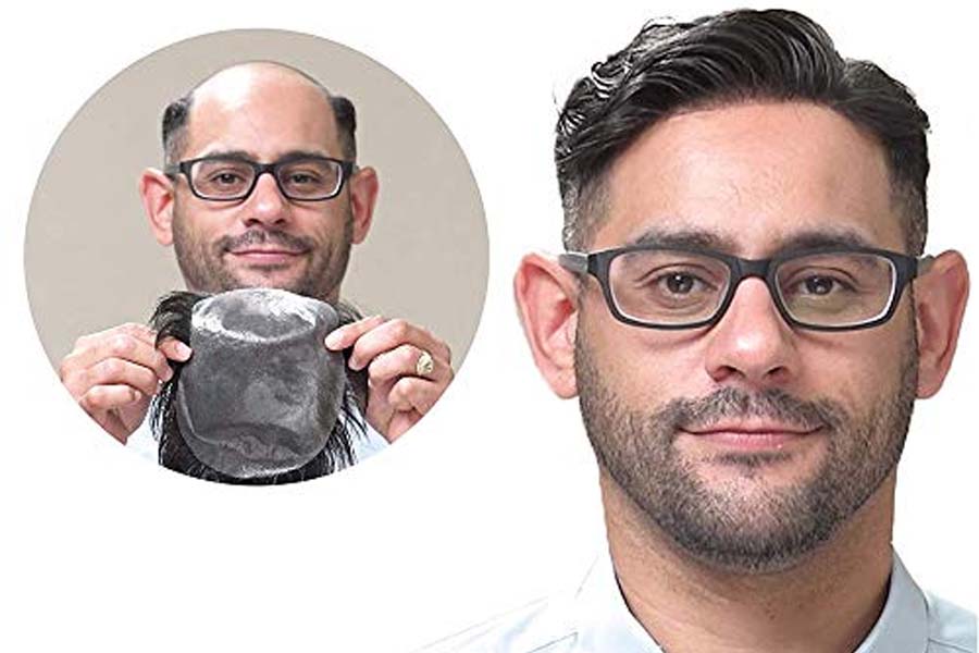 راهنمای خرید پروتز موی مناسب برای آقایان