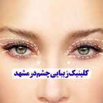 کلینیک زیبایی چشم در مشهد