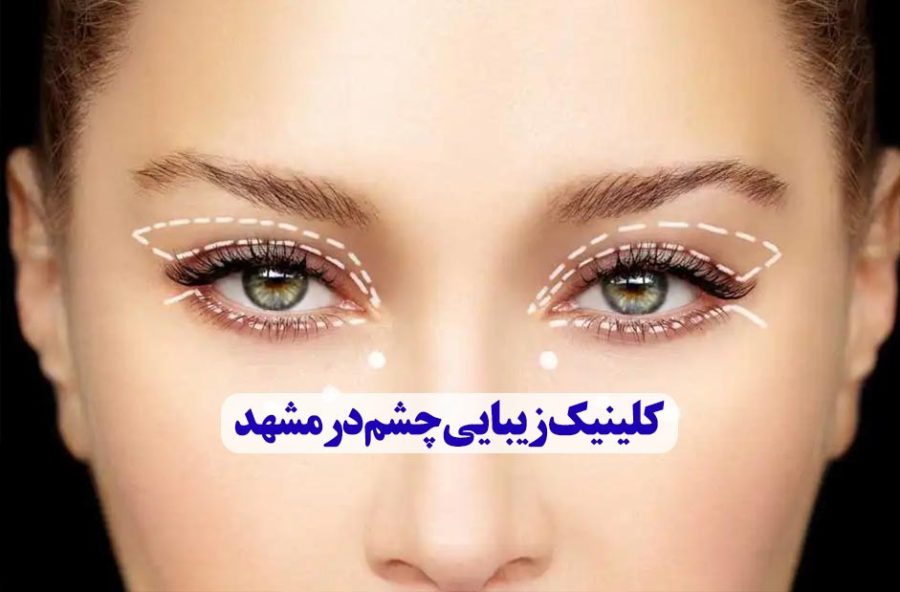 کلینیک زیبایی چشم در مشهد