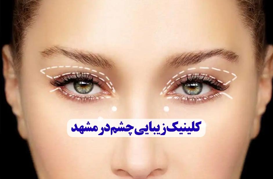 کلینیک زیبایی چشم در مشهد